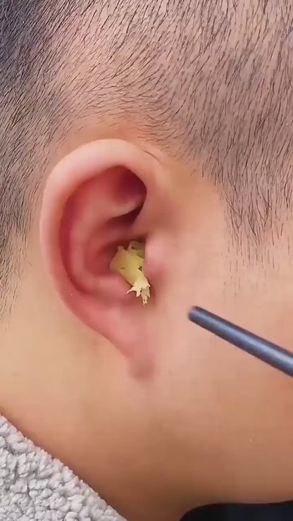 Ear Wax Cleaning Kit